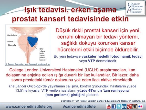 Işık tedavisi, prostat kanseri - Cancer Education and Research Institute (CERI)