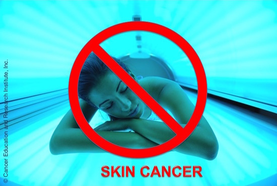 Skin cancer risk through tanning - Cancer Education and Research Institute (CERI) 