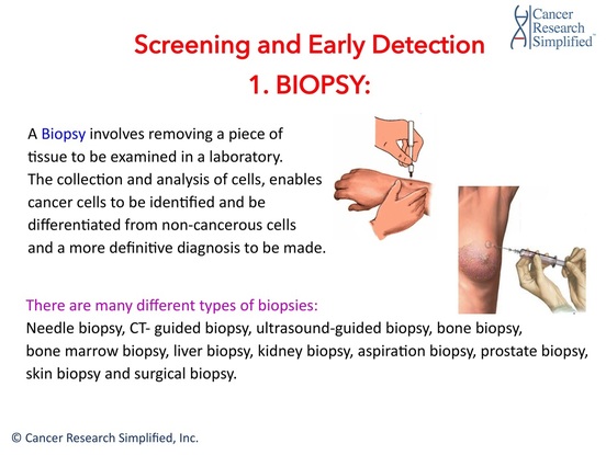 Cancer screening and early detection - Cancer Research Simplified 