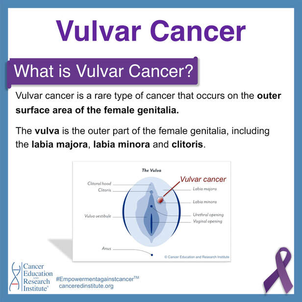 What is vulvar cancer? | Cancer Education and Research Institute (CERI)
