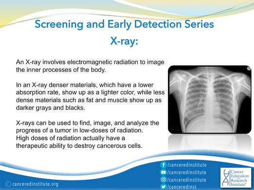 Cancer detection - cancer detection methods - X-ray - Cancer Education and Research Institute (CERI)